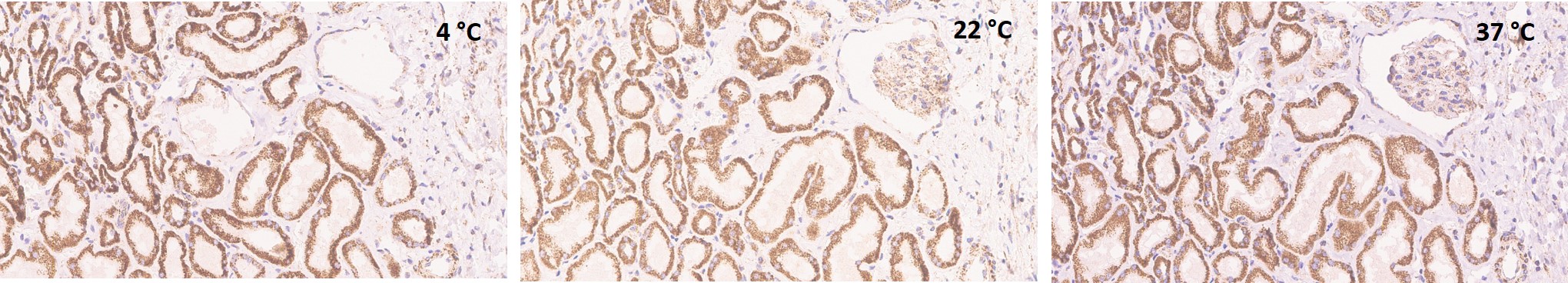 Immunohistochemistry (Formalin/PFA-fixed paraffin-embedded sections) - Anti-BMP4 antibody [EPR6211] (AB124715)
