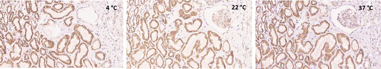 Immunohistochemistry (Formalin/PFA-fixed paraffin-embedded sections) - Anti-BMP4 antibody [EPR6211] (AB124715)