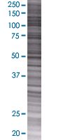 BMP5 overexpression 293T lysate (whole cell)