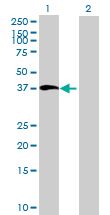 Western blot - BMP5 overexpression 293T lysate (whole cell) (AB94188)