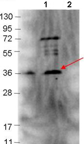 Western blot - Anti-bmpA antibody (AB106085), expandable thumbnail