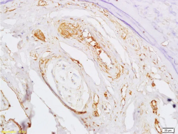 Immunohistochemistry (Formalin/PFA-fixed paraffin-embedded sections) - Anti-BMPR1A antibody (AB264043)