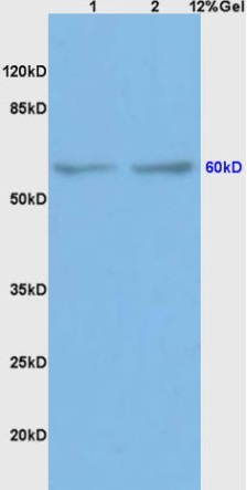 Western blot - Anti-BMPR1A antibody (AB264043)