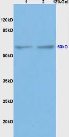 Western blot - Anti-BMPR1A antibody (AB264043)