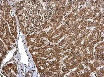 Immunohistochemistry (Formalin/PFA-fixed paraffin-embedded sections) - Anti-BMPR1B antibody (AB155058)