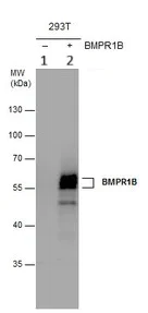Western blot - Anti-BMPR1B antibody (AB155058)
