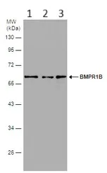 Western blot - Anti-BMPR1B antibody (AB155058)