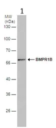 Western blot - Anti-BMPR1B antibody (AB155058)