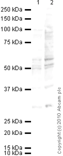 Western blot - Anti-BMPR1B antibody [MM0055-3E12] (AB78417)