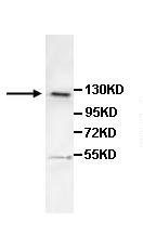 Western blot - Anti-BMPR2 antibody (AB106266)