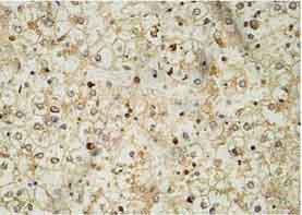 Immunohistochemistry (Formalin/PFA-fixed paraffin-embedded sections) - Anti-BMPR2 antibody (AB124463)