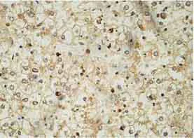 Immunohistochemistry (Formalin/PFA-fixed paraffin-embedded sections) - Anti-BMPR2 antibody (AB124463)