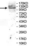 Western blot - Anti-BMPR2 antibody (AB124463)