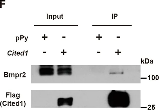Western blot - Anti-BMPR2 antibody (AB96826)