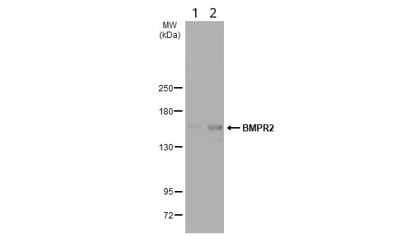 Western blot - Anti-BMPR2 antibody (AB96826)