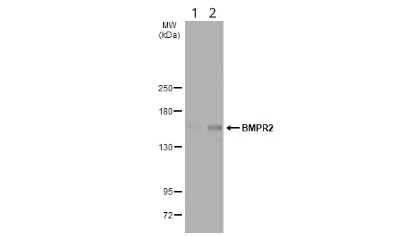 Western blot - Anti-BMPR2 antibody (AB96826)