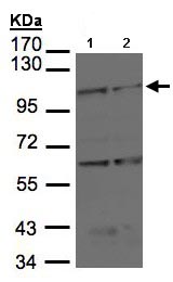 Western blot - Anti-BMPR2 antibody (AB96826), expandable thumbnail