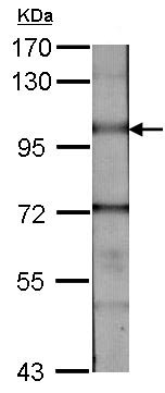 Western blot - Anti-BMPR2 antibody (AB96826), expandable thumbnail