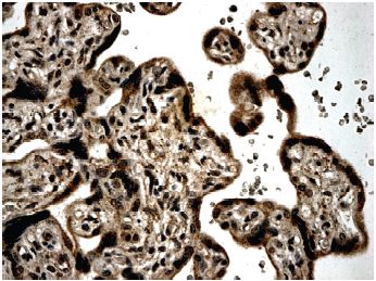 Immunohistochemistry (Formalin/PFA-fixed paraffin-embedded sections) - Anti-BMPR2 antibody [MM0060-9A10] (AB78422)