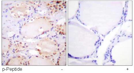 Immunohistochemistry (Formalin/PFA-fixed paraffin-embedded sections) - Anti-BMX (phospho Y566) antibody (AB59409)