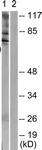 Western blot - Anti-BMX (phospho Y566) antibody (AB59409)