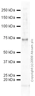 Western blot - Anti-BMX (phospho Y566) antibody (AB59409)