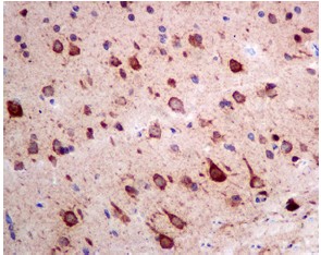 Immunohistochemistry (Formalin/PFA-fixed paraffin-embedded sections) - Anti-BNIP1 antibody [EPR10024] - BSA and Azide free (AB248998), expandable thumbnail