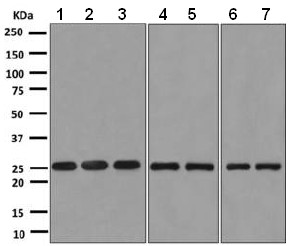 Western blot - Anti-BNIP1 antibody [EPR10024] - BSA and Azide free (AB248998), expandable thumbnail