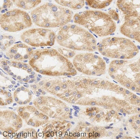 Immunohistochemistry (Formalin/PFA-fixed paraffin-embedded sections) - Anti-BNIP3 antibody [ANa40] (AB10433)