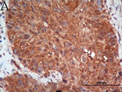 Immunohistochemistry (Formalin/PFA-fixed paraffin-embedded sections) - Anti-BNIP3 antibody [ANa40] (AB10433)