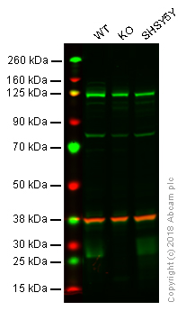 Western blot - Anti-BNIP3 antibody [ANa40] (AB10433), expandable thumbnail