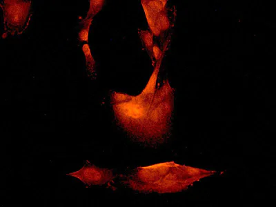 Immunocytochemistry/ Immunofluorescence - Anti-BNIP3 antibody [EPR4034] (AB109362)