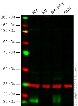 Western blot - Anti-BNIP3 antibody [EPR4034] (AB109362)