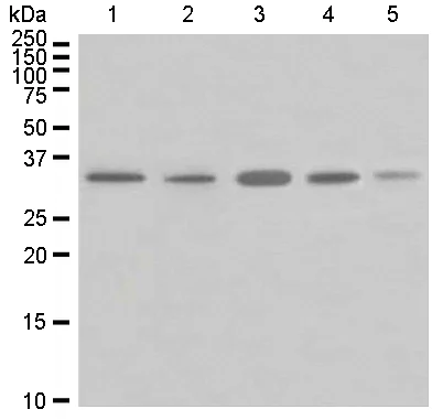 Western blot - Anti-BNIP3 antibody [EPR4034] (AB109362)