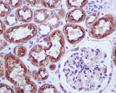 Immunohistochemistry (Formalin/PFA-fixed paraffin-embedded sections) - Anti-BNIP3 antibody [EPR4034] - BSA and Azide free (AB219609), expandable thumbnail