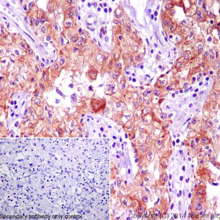 Immunohistochemistry (Formalin/PFA-fixed paraffin-embedded sections) - Anti-BNIP3 antibody [EPR4034] - BSA and Azide free (AB219609), expandable thumbnail