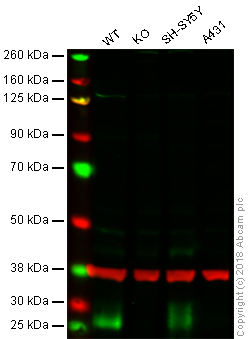 Western blot - Anti-BNIP3 antibody [EPR4034] - BSA and Azide free (AB219609), expandable thumbnail