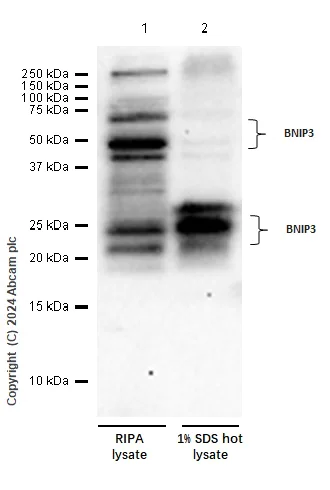 Western blot - Anti-BNIP3 antibody [EPR4034] - BSA and Azide free (AB219609)