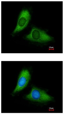 Immunocytochemistry/ Immunofluorescence - Anti-BNIP3L/NIX antibody (AB155010), expandable thumbnail