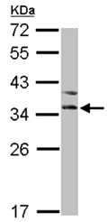 Western blot - Anti-BNIP3L/NIX antibody (AB155010), expandable thumbnail