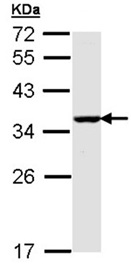 Western blot - Anti-BNIP3L/NIX antibody (AB155010), expandable thumbnail