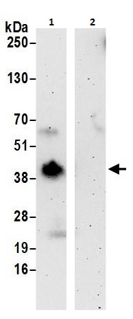 Immunoprecipitation - Anti-BNIP3L/NIX antibody (AB264312)