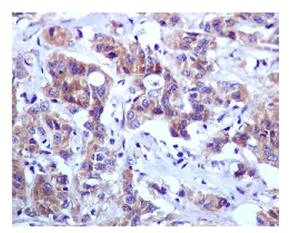 Immunohistochemistry (Formalin/PFA-fixed paraffin-embedded sections) - Anti-BNIP3L/NIX antibody [EPR4033] (AB109414)