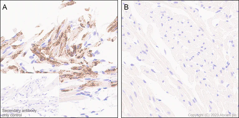 Immunohistochemistry (Formalin/PFA-fixed paraffin-embedded sections) - Anti-BNP antibody [EPR20260-222] (AB309127)