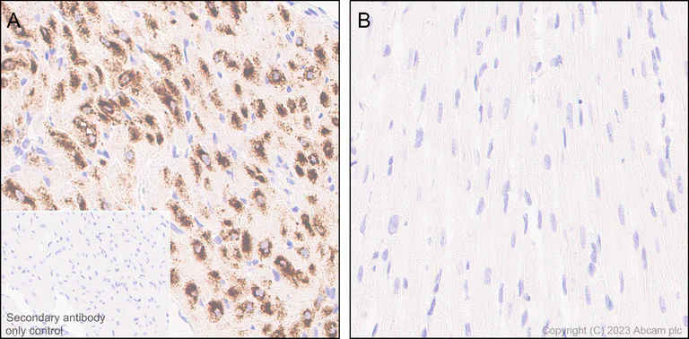 Immunohistochemistry (Formalin/PFA-fixed paraffin-embedded sections) - Anti-BNP antibody [EPR20260-222] - BSA and Azide free (AB309128)