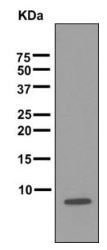 Western blot - Anti-BNP antibody [EPR3736] (AB174856), expandable thumbnail