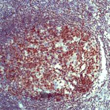 Immunohistochemistry (Formalin/PFA-fixed paraffin-embedded sections) - Anti-BOB1 antibody (AB52103)
