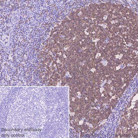 Immunohistochemistry (Formalin/PFA-fixed paraffin-embedded sections) - Anti-BOB1 antibody [SP92] (AB99891), expandable thumbnail