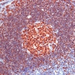 Immunohistochemistry (Formalin/PFA-fixed paraffin-embedded sections) - Anti-BOB1 antibody [SP92] (AB99891), expandable thumbnail