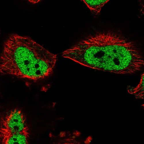 Immunocytochemistry/ Immunofluorescence - Anti-BOD1L antibody (AB122380)